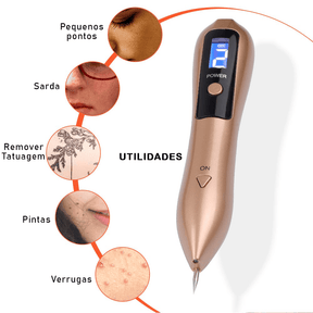 CANETA LASER (REMOVEDORA DE MANCHAS E VERRUGAS) - Loja Tudo Aqui